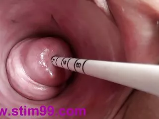 Post-Op Ladyboy Aloun Fucked Bareback